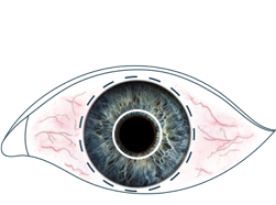 An illustration of an unblinking eye