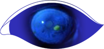 Fluorescein staining of an eye with stage 2 neurotrophic keratitis (NK) as seen under cobalt blue light