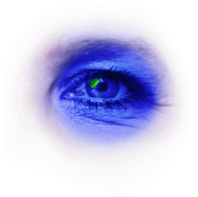 A closeup of Linda’s eye under cobalt blue light revealing persistent epithelial defect