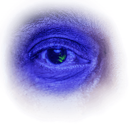 A closeup of Carl’s eye being examined under cobalt blue light